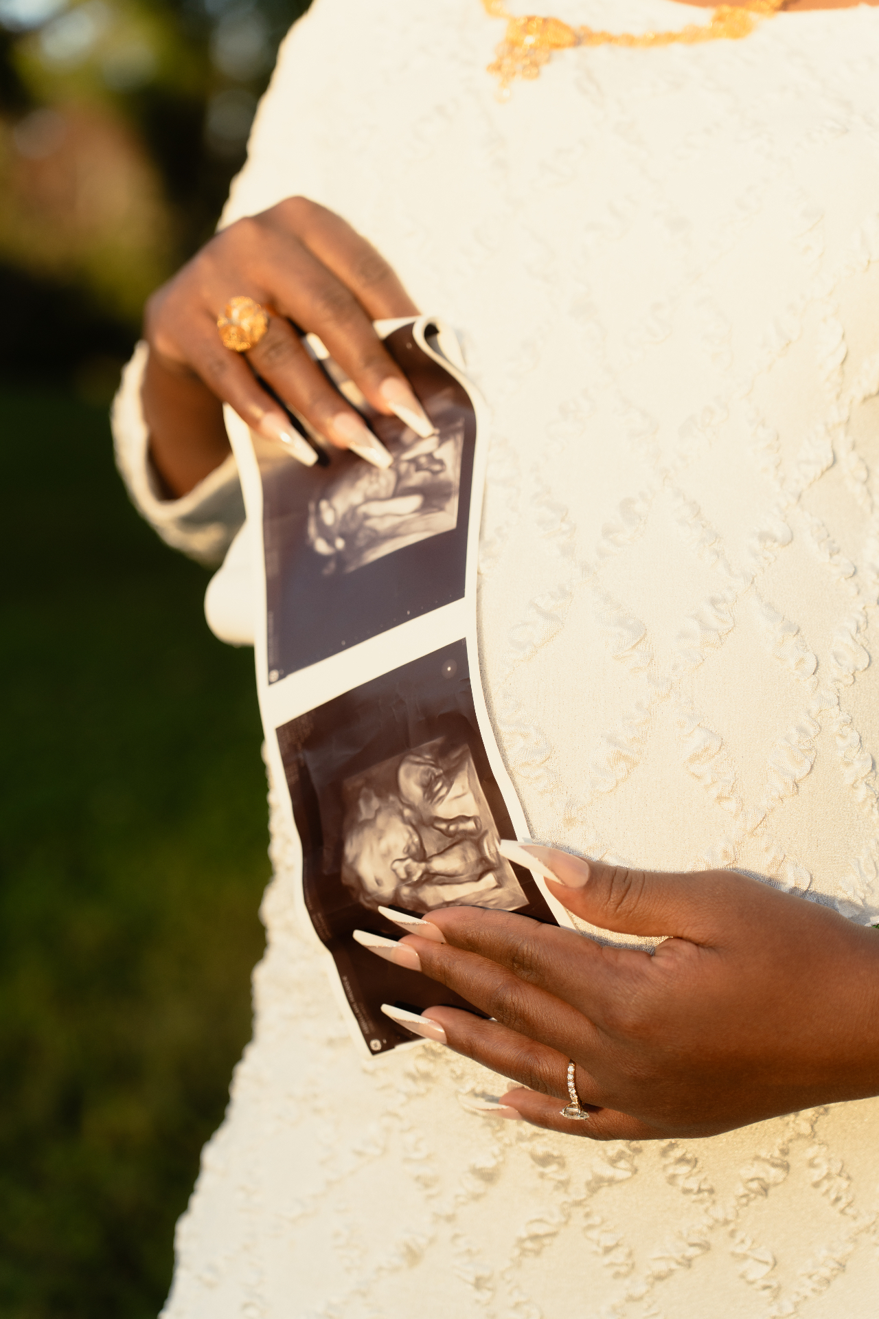 Maternity — ultrasound detail